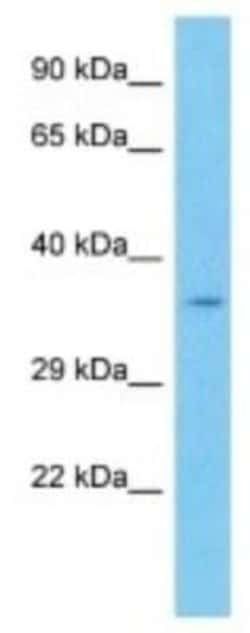 TCF7/TCF1 Rabbit anti-Mouse, Polyclonal, Novus Biologicals:Antibodies:Primary